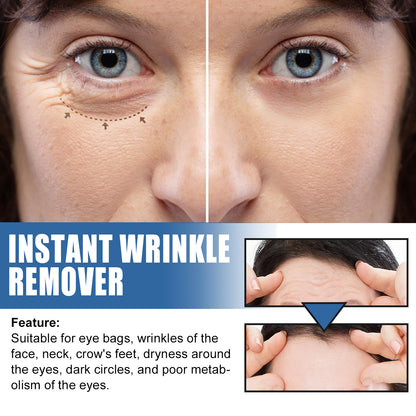 5 Seconds Retinol Wrinkle Lift Cream Fade Eyes